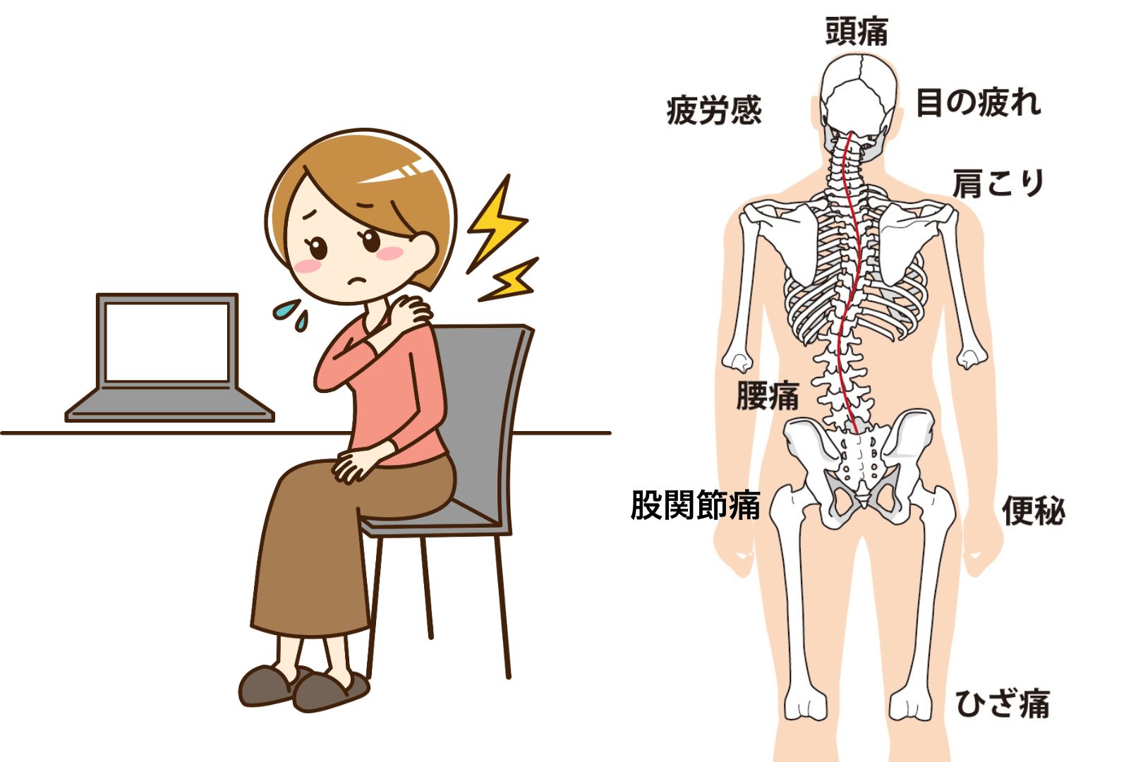 肩こりに悩む女性