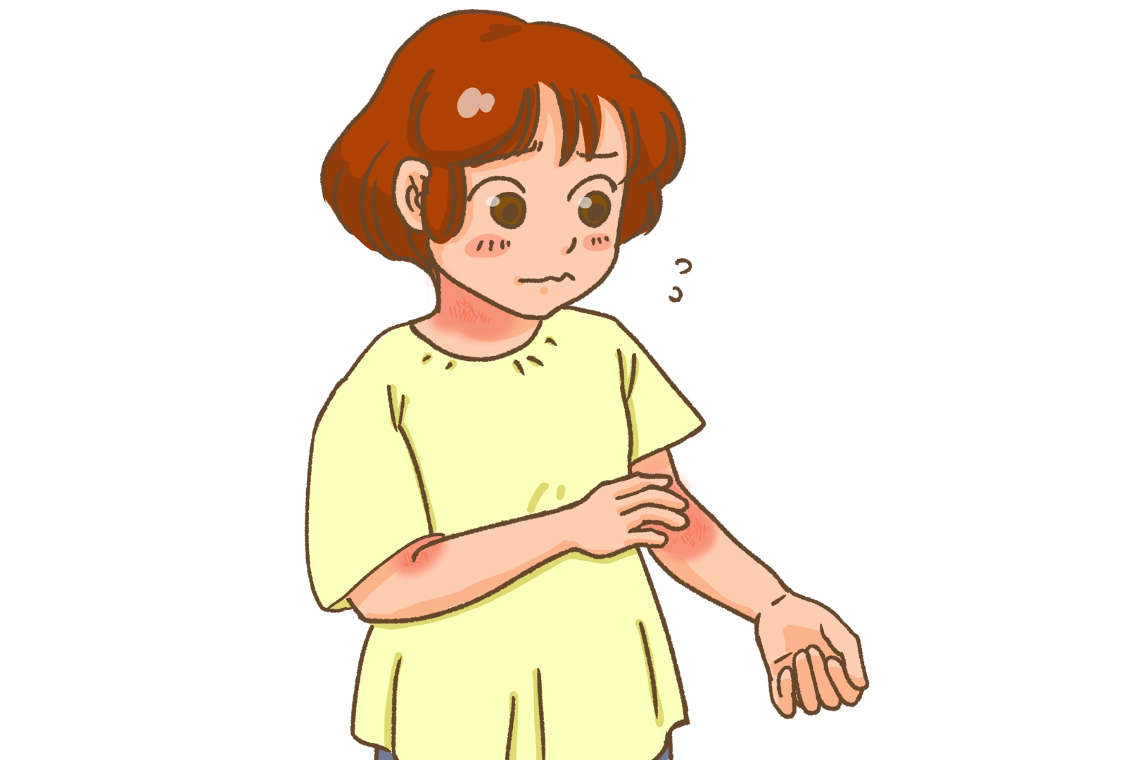 アトピー性皮膚炎に悩む女性
