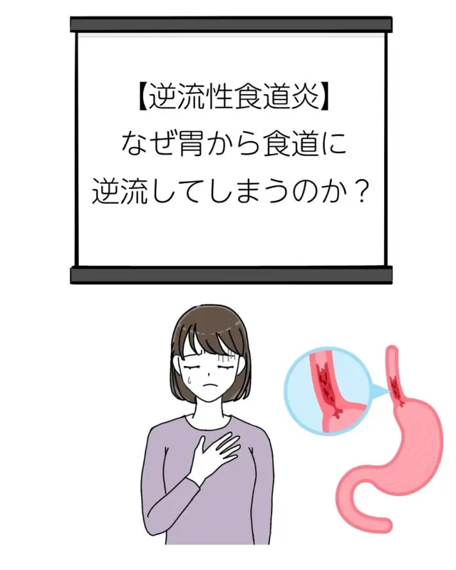 こんにちは^^　逆流性食道炎について、コラムを書かせて頂きました。

よろしければ、ご覧ください。

こちらをタップして「整体コラム」へ
　↓
@aalto_seitai


#逆流性食道炎
#胸やけ
#胃酸逆流
#喉の違和感
#呑酸
#吐き気
#夜間の不眠
#自律神経の乱れ
#体の歪み
#姿勢改善
#整体
#草津整体
#草津アアルト整体院
#根本改善
#薬に頼らない
#健康な体作り
#ストレス解消
#胃腸ケア
#体験談あり
#院長村岸毅